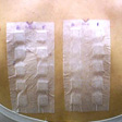 Patch tests containing tea tree oil are used to determine skin sensitivity. Courtesy University of Western Australia Department of Microbiology.